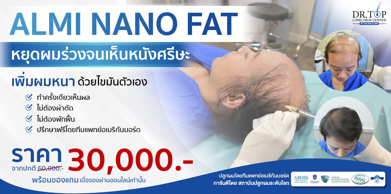 ปลูกผมด้วยไขมัน กระตุ้นรากผม ฉีดไขมัน